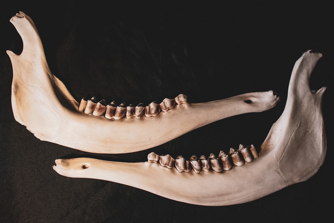 Waarom baby’s meer botten hebben dan volwassenen